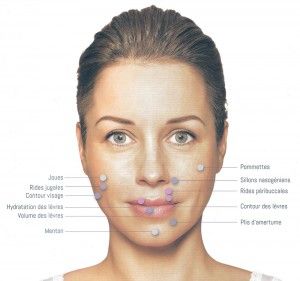 injection-acide-hyaluronique